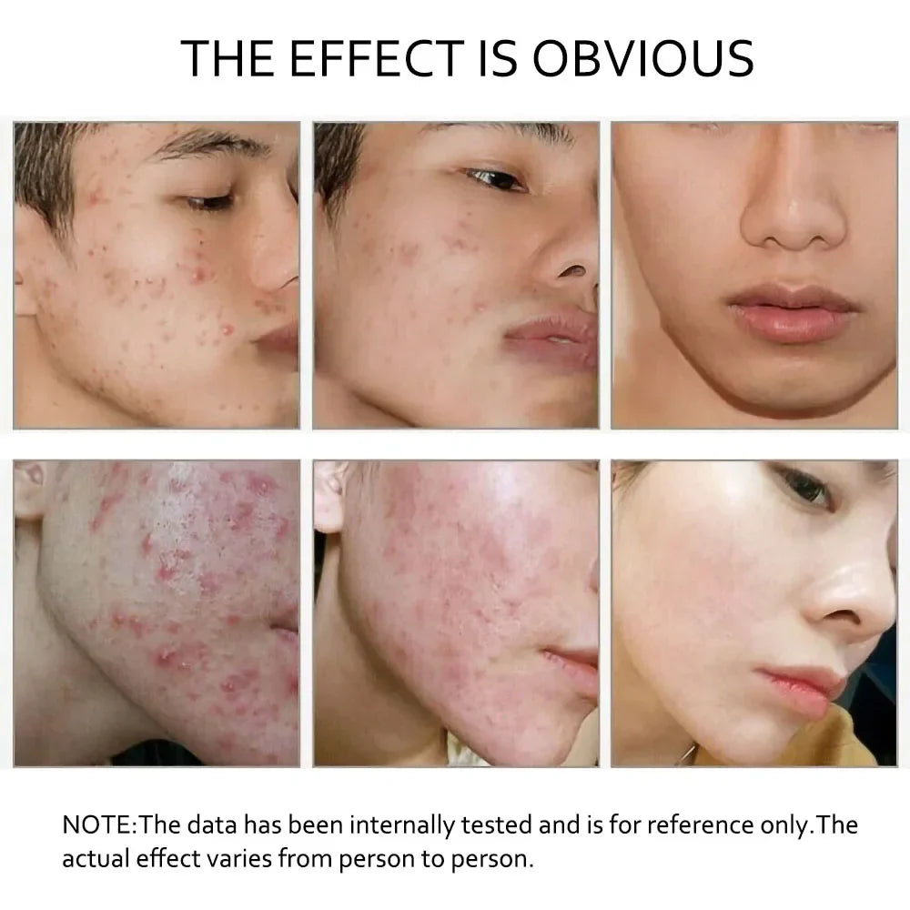 Retinol Serum Anti Wrinkle