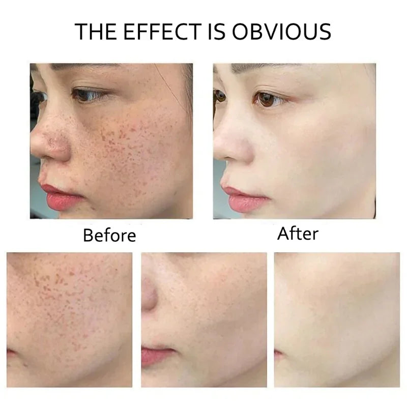 Retinol Serum Anti Wrinkle