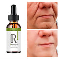 Retinol Serum Anti Wrinkle
