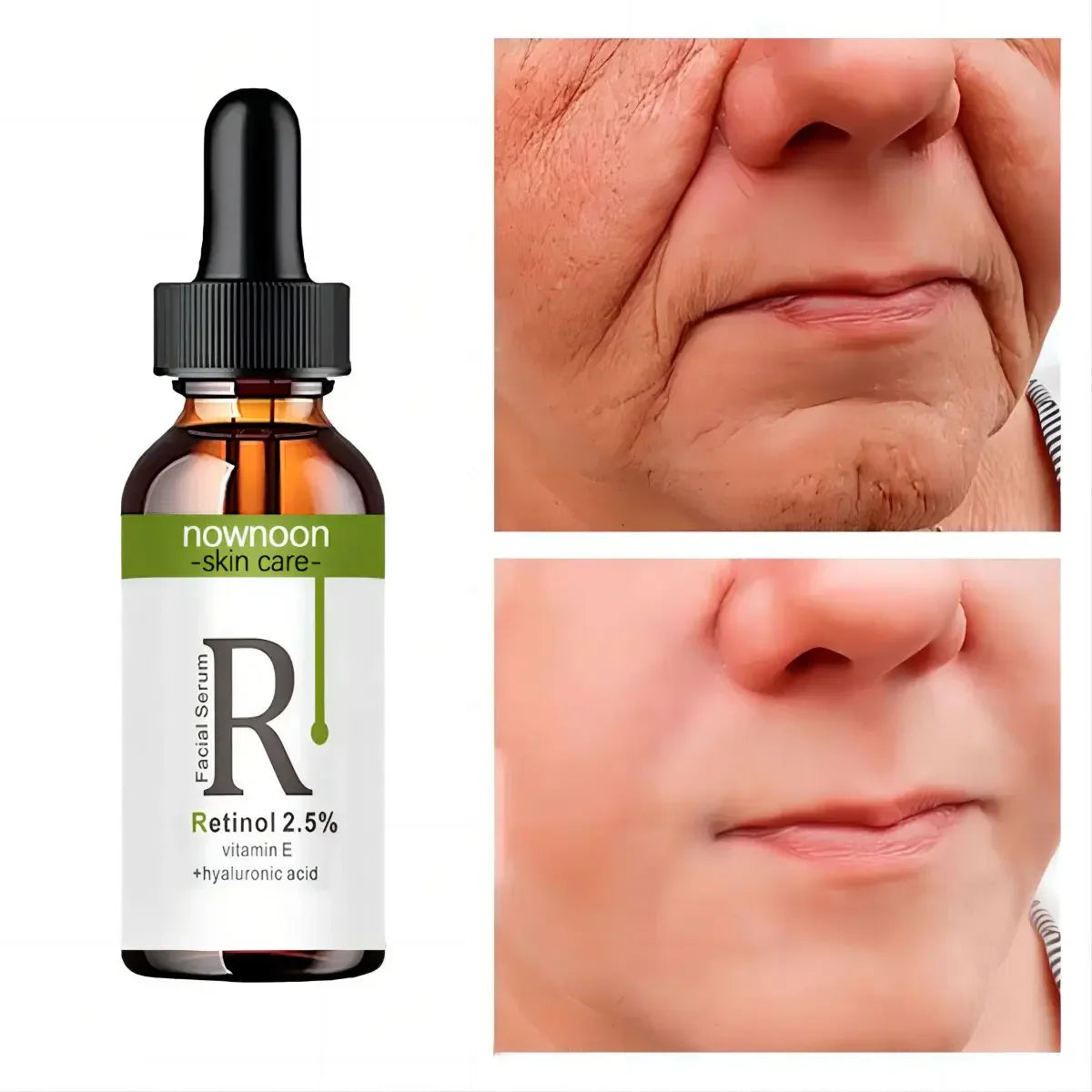 Retinol Serum Anti Wrinkle